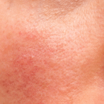 Skin Barrier Skincare: Fokus Baru dalam Dunia Kecantikan artikel (18)